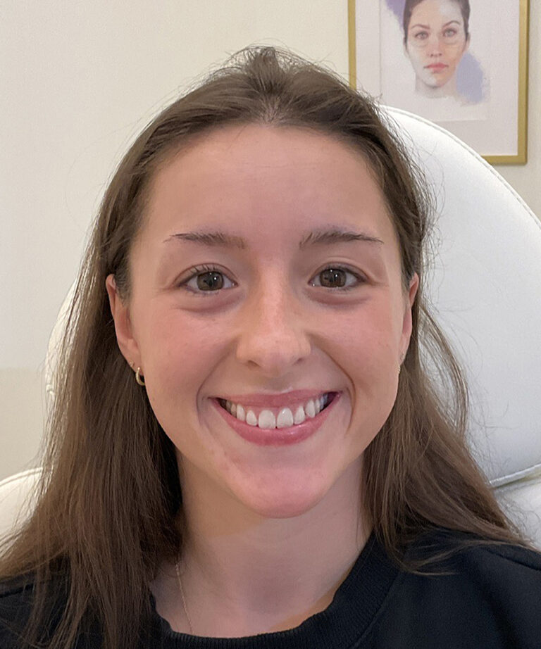 Before Image: Lip Filler, Lip Flip - front